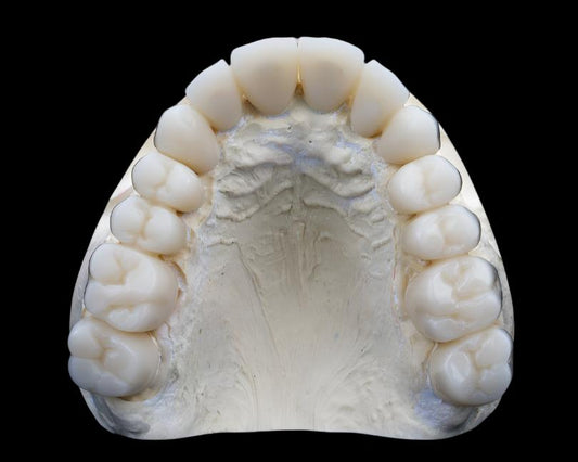 PMMA Temporary Crowns