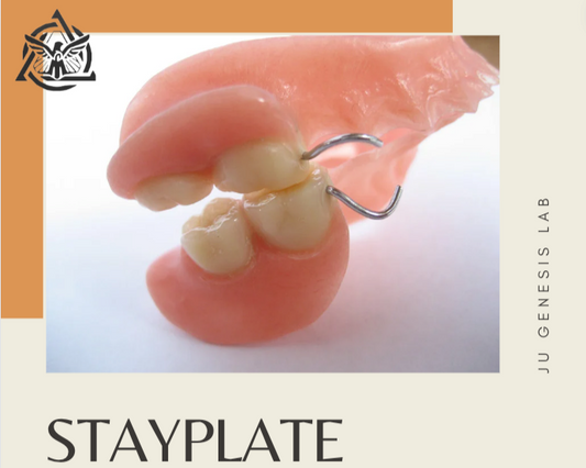 Stay Plate/ Flipper