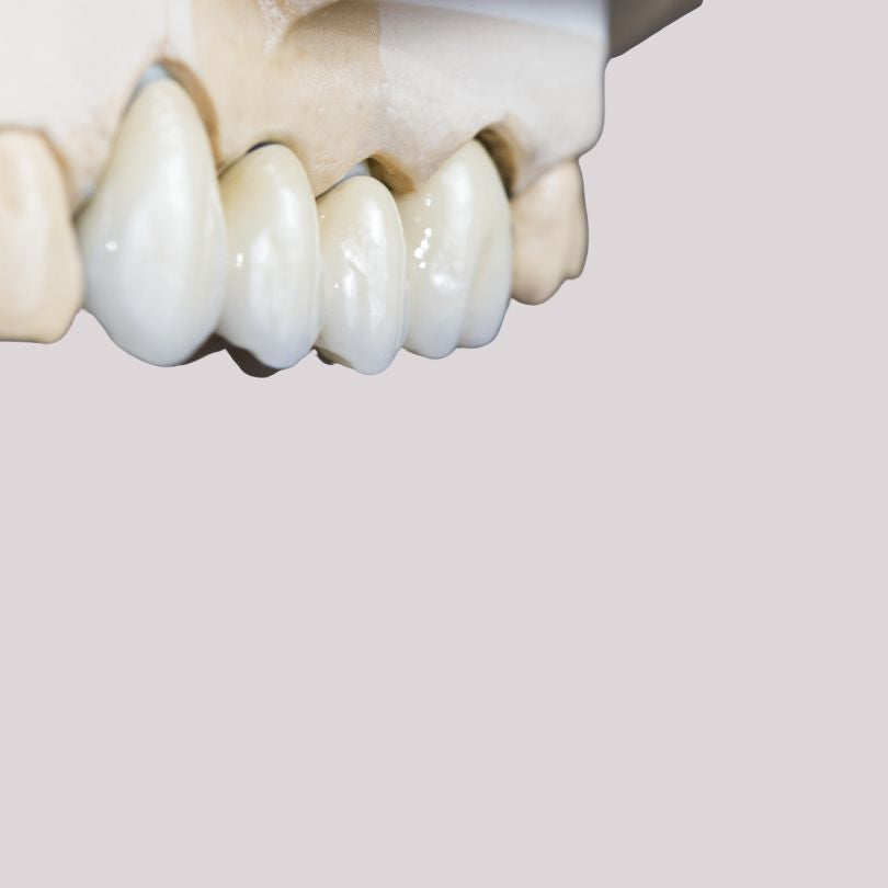 Full Zirconia Crowns(Monolithic)