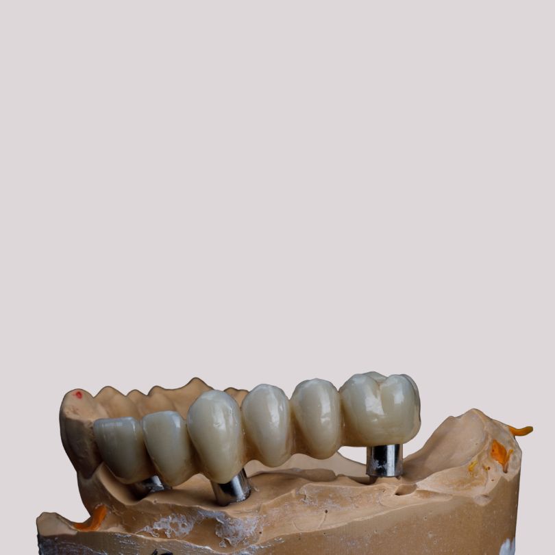 Full Zirconia Crowns(Monolithic)