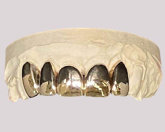 Full Metal Crowns