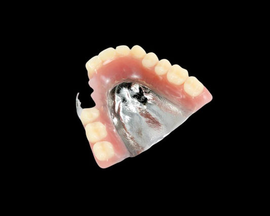 Partial Denture