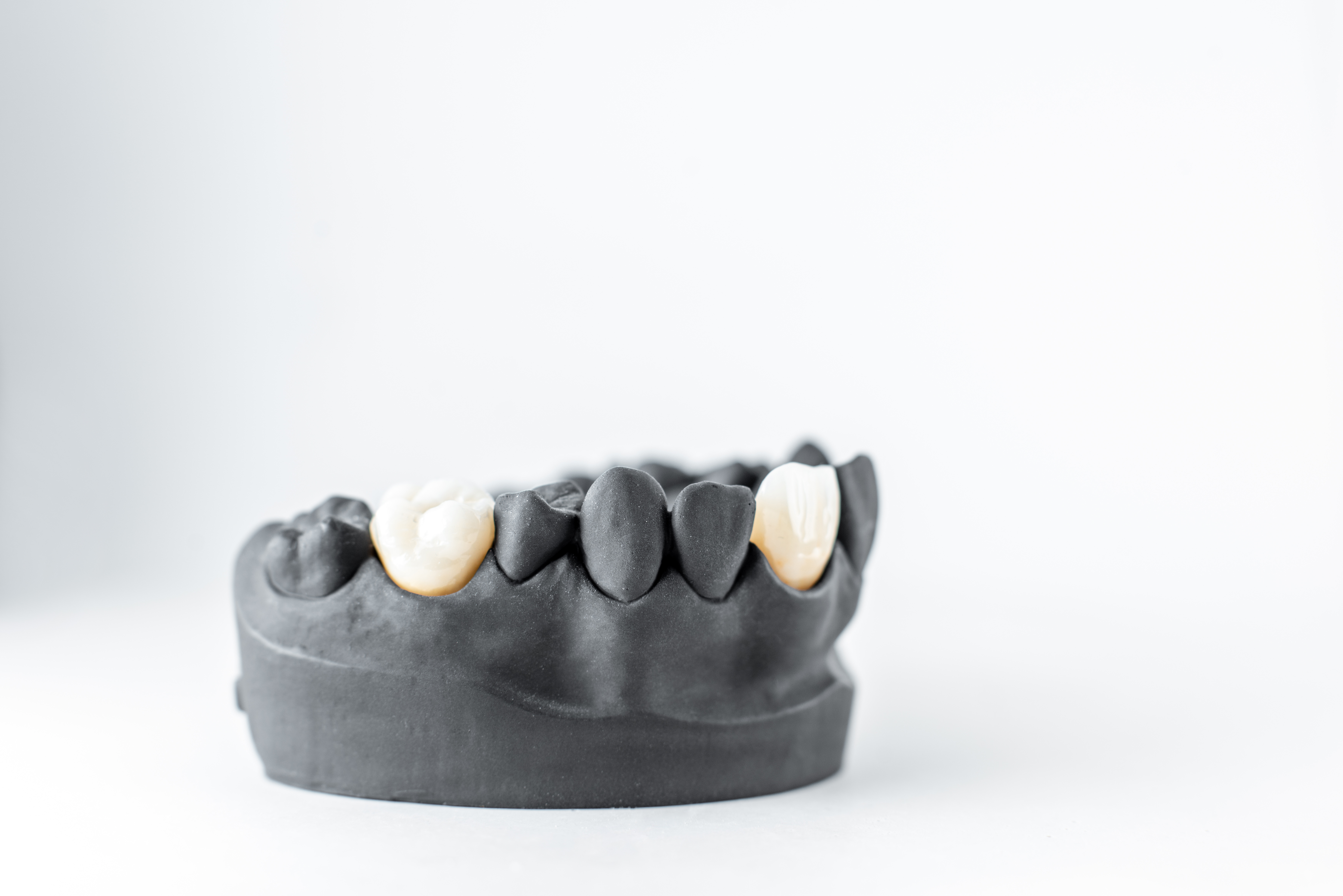 Implant jaw model