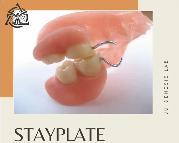 Stay Plate