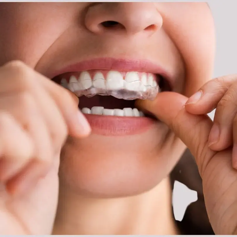Clear retainer lower